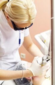 Gydytojas atlieka fototermolizės procedūrą